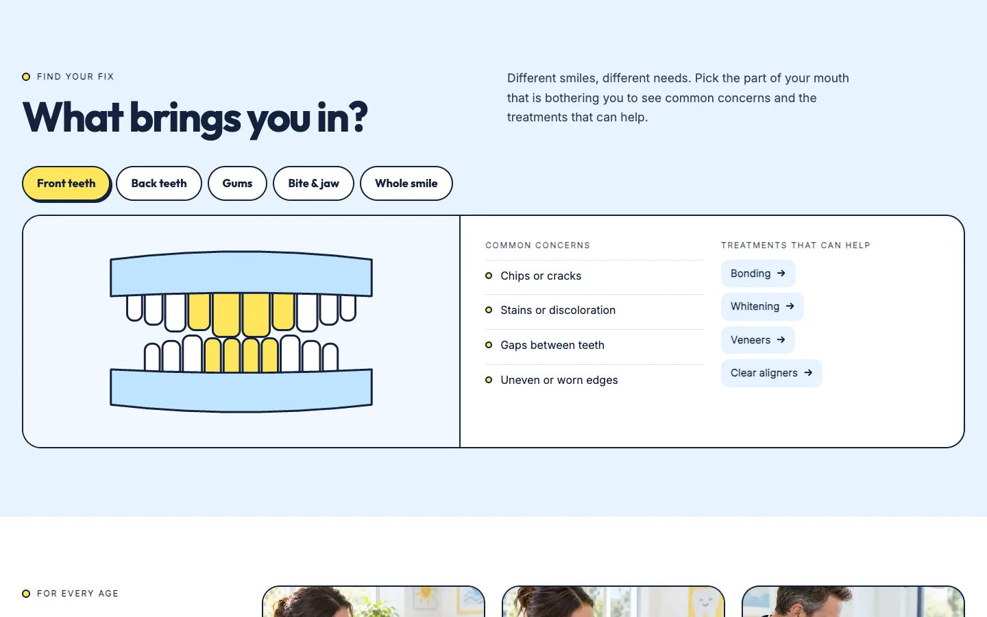 Beam: What brings you in? / tooth diagrams